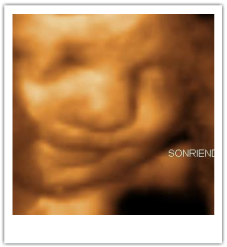 3D Ultrasound 30 Weeks